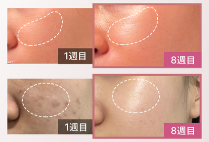 BeautyPulse™ EMSフェイシャルビューティーデバイス 自宅で簡単リフトアップケア  USB充電式・軽量フェイシャル美顔器